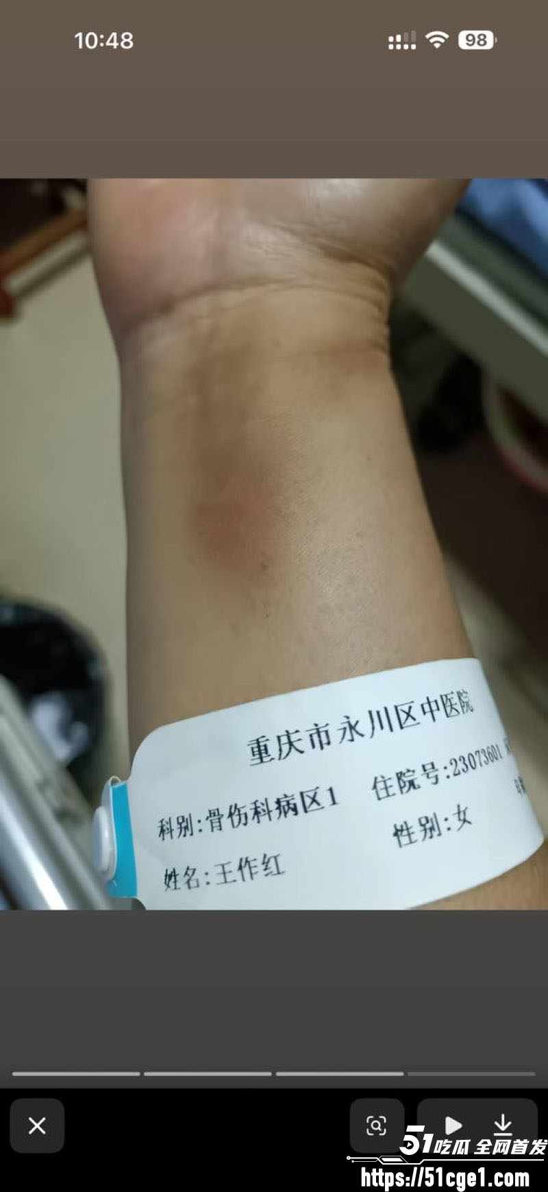 重庆53岁 王作红 遭丈夫家暴10多次 伤情照曝光还出轨藏1400万 性爱视频被传全网！